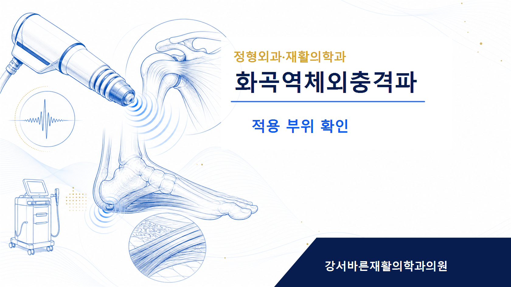 체외충격파 치료 전 체크리스트 이미지