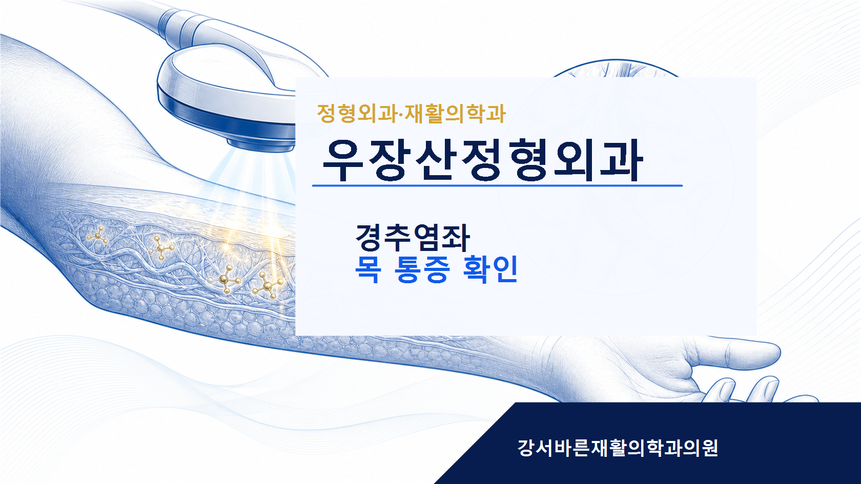우장산정형외과 경추염좌 안내 이미지